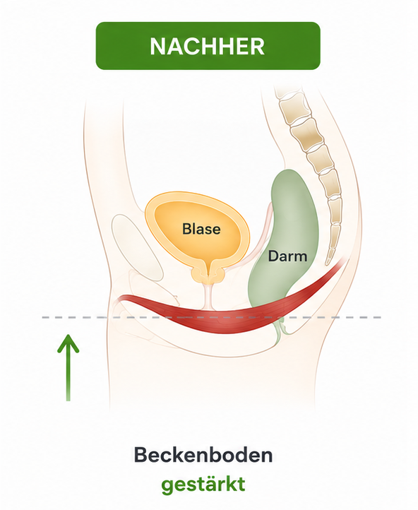 Nach Behandlung Beckenboden Frau 